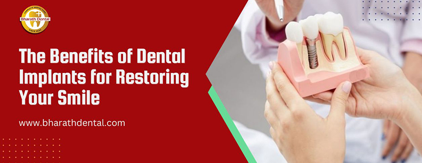 The Benefits of Dental Implants for Restoring Your Smile