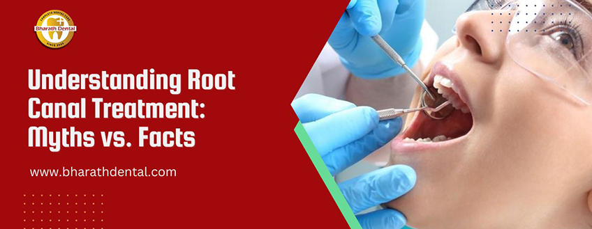 Understanding Root Canal Treatment: Myths vs. Facts