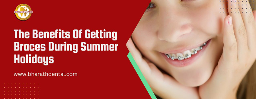 The Benefits Of Getting Braces During Summer Holidays